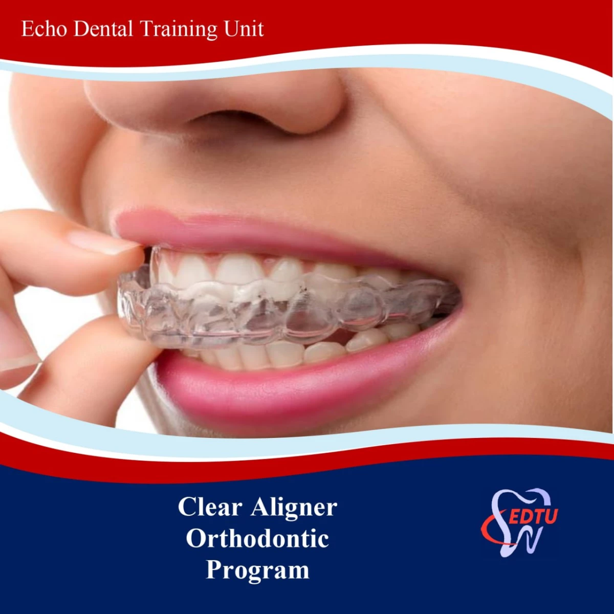 Clear Aligner Orthodontic Course