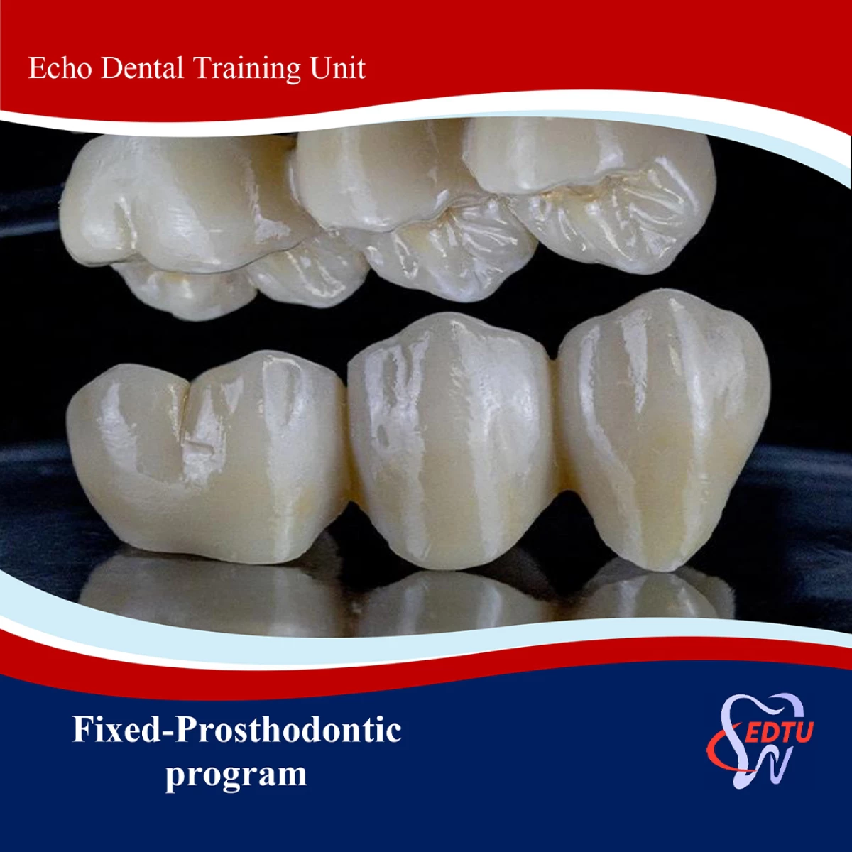 Basics and advances Fixed Prosthodontics