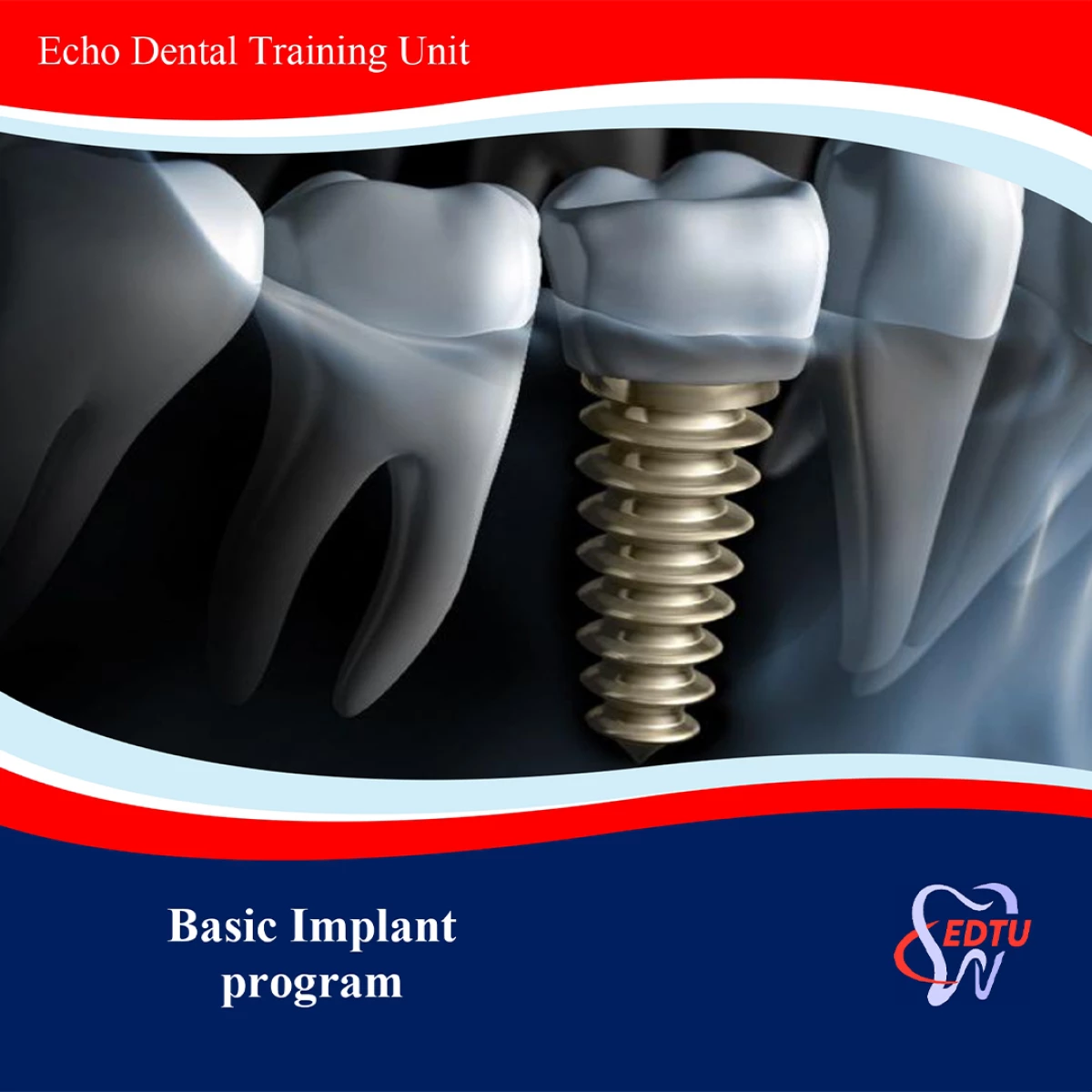 IMPLANT COURSES